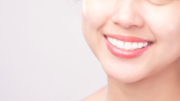 woman smiling with bright white teeth